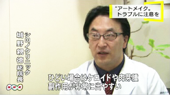 アートメイクに注意！健康被害や失敗の相談121件！医療資格持たないエステの施術が95％！